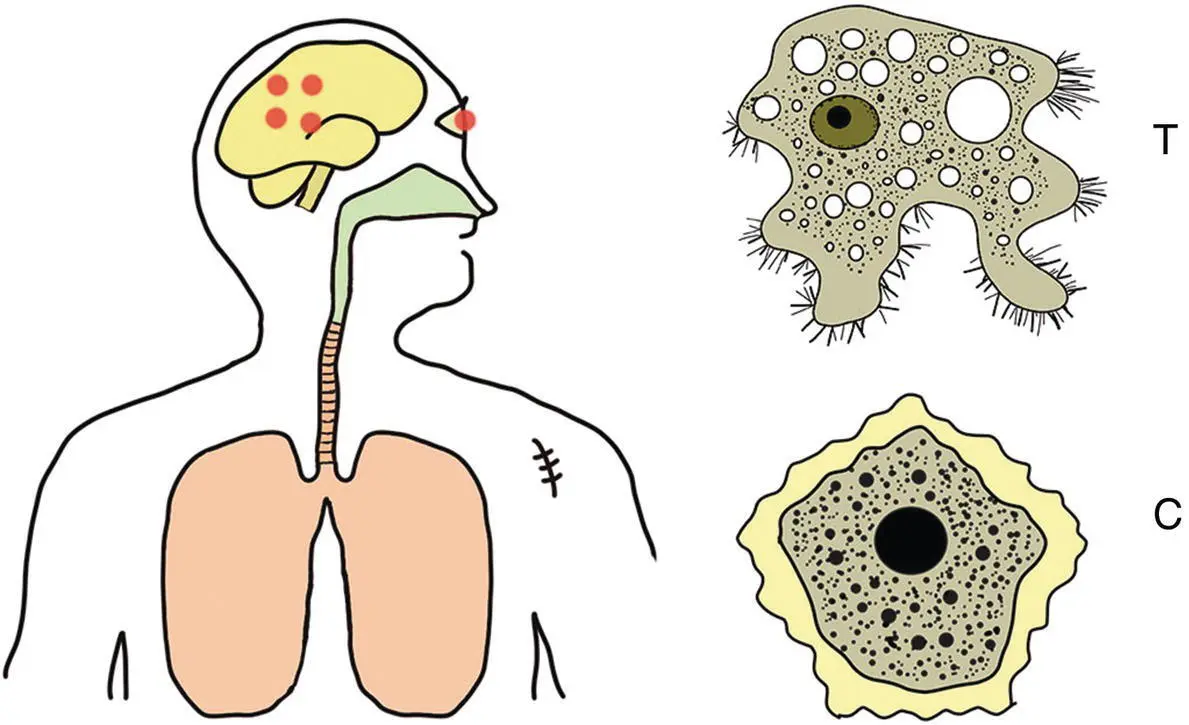 Figure 35 Life cycle of Acanthamoeba spp These amoebae are normally - фото 13