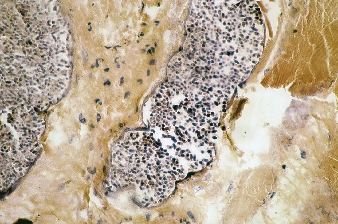 Figure 315 Transverse section through a sarcocysts of Sarcocystis muris in the - фото 23