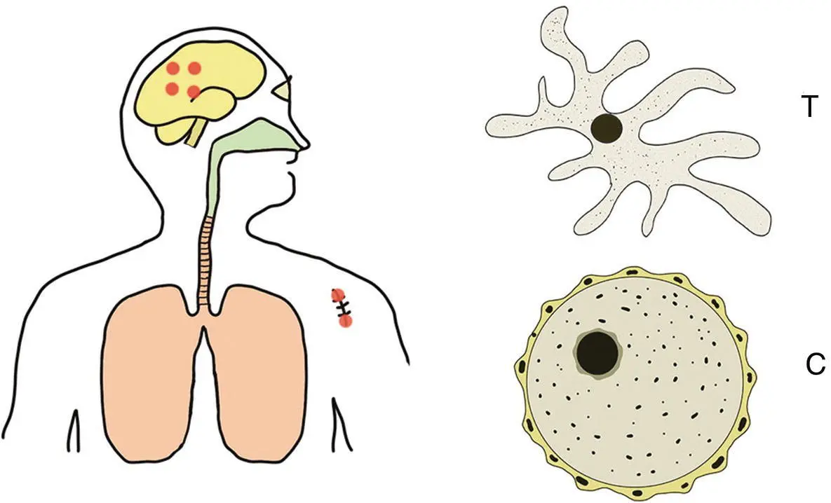 Figure 34 Life cycle of Balamuthia mandrillaris This species exists either - фото 12