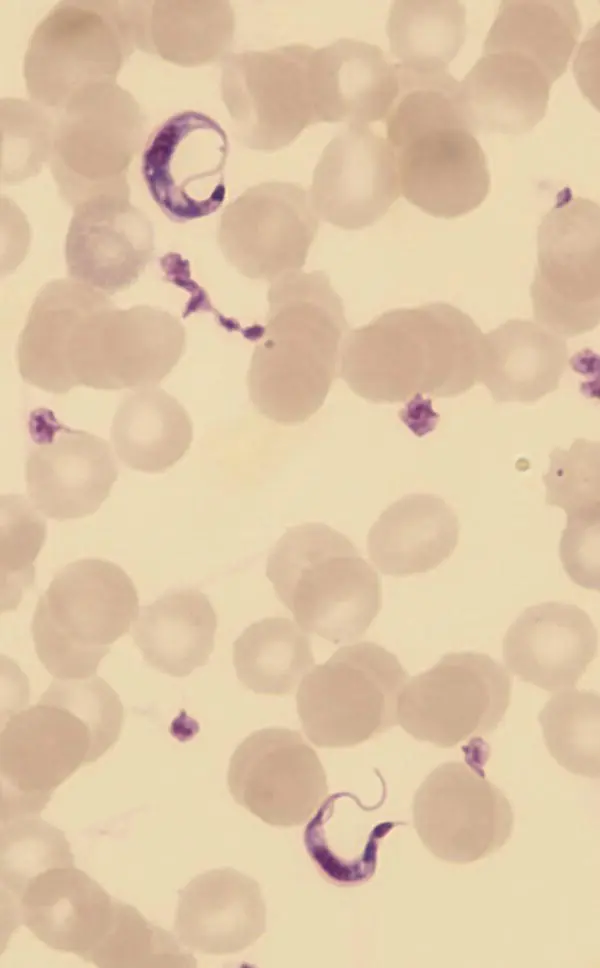 Figure 410 Trypanosoma cruzi Note the characteristic C shape often seen in - фото 35