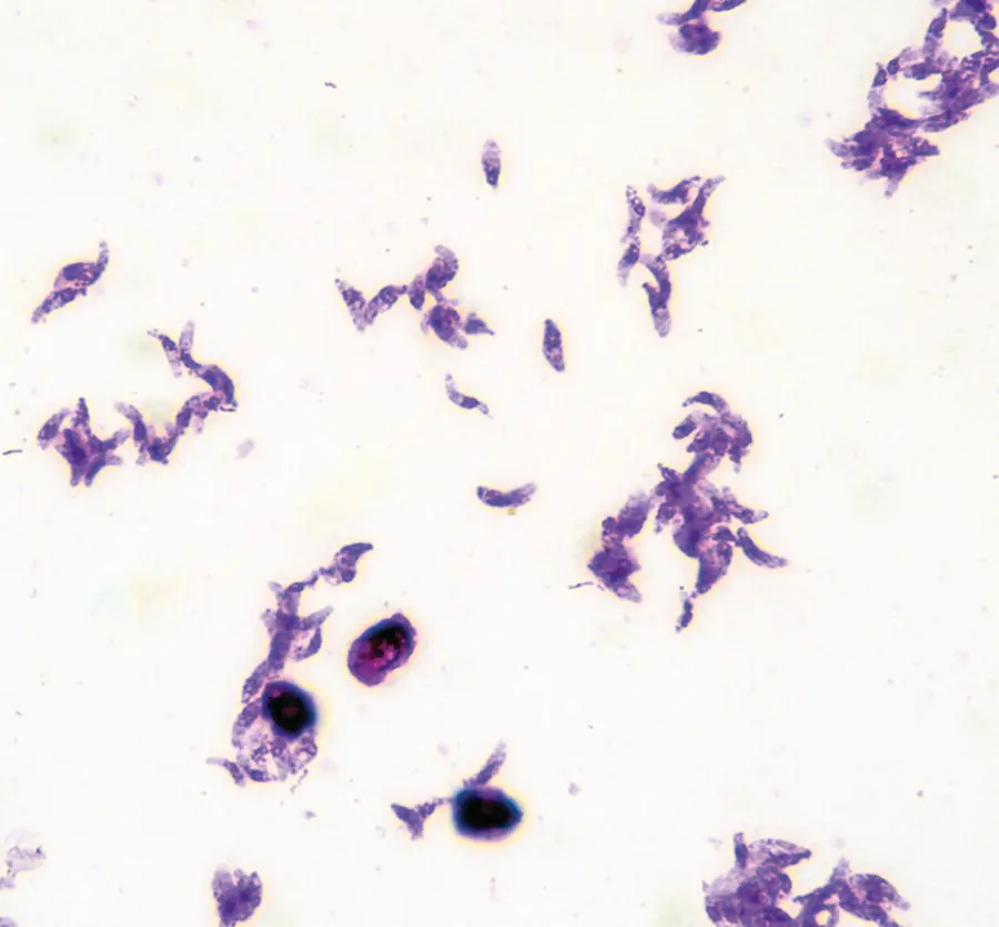 Figure 316 Toxoplasma gondii tachyzoites This protozoan parasite has an - фото 24