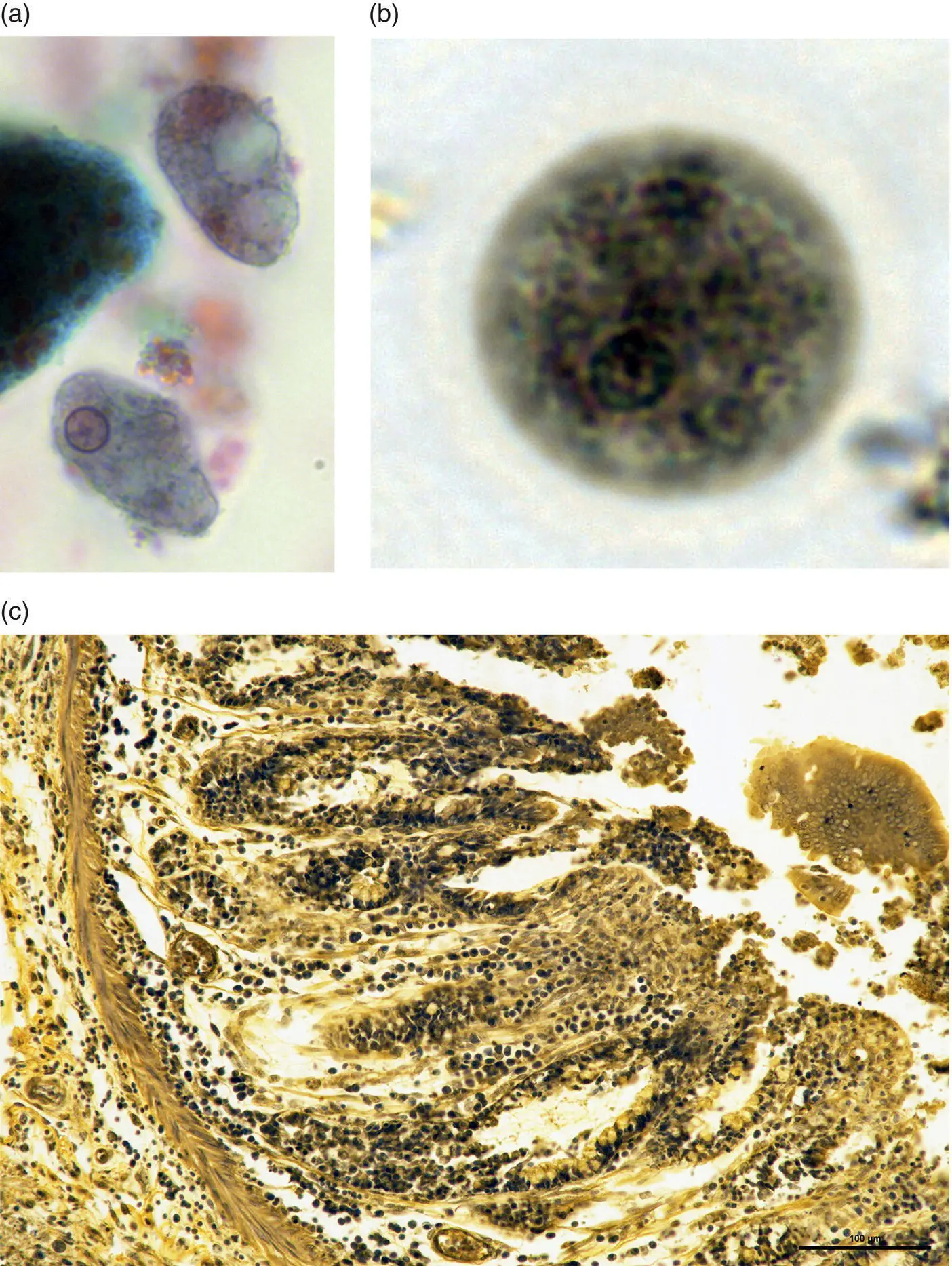 Figure 32 Entamoeba histolytica a Trophozoite in a histological section - фото 10