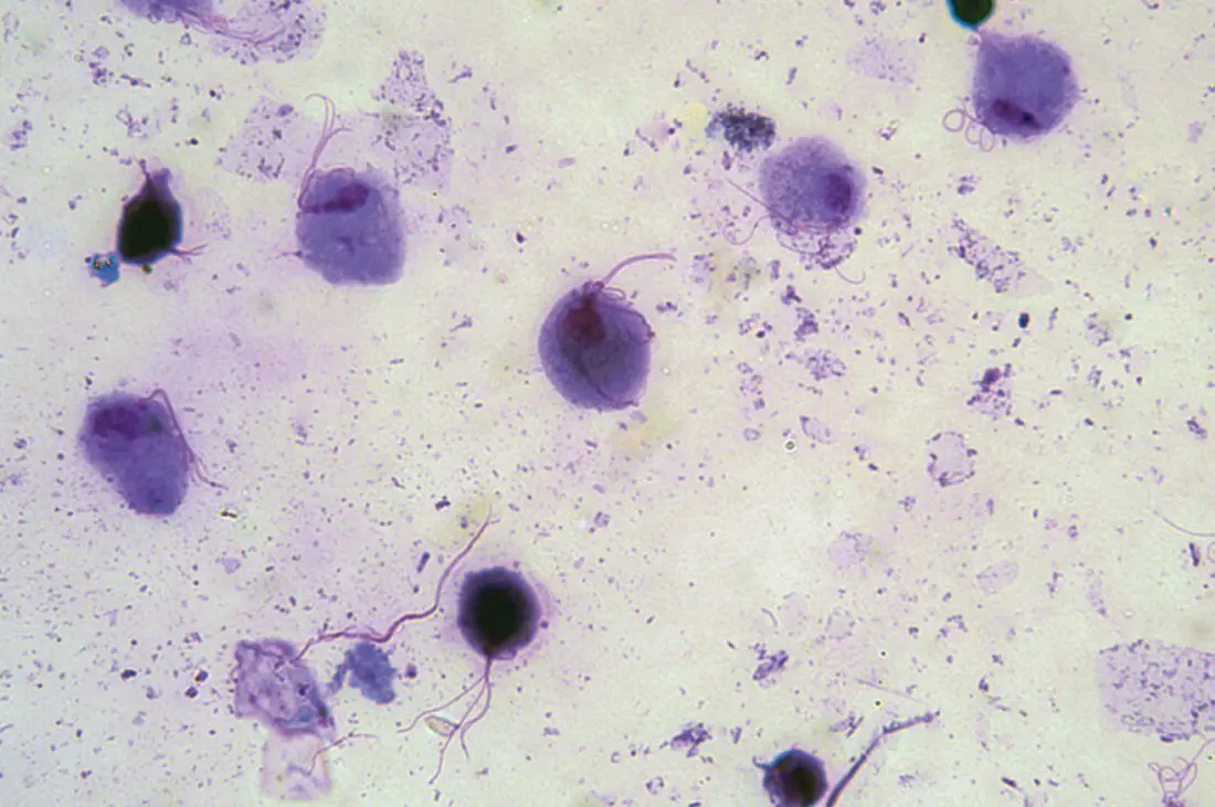 Figure 37 Trichomonas vaginalis This protozoan parasite expresses only one - фото 15