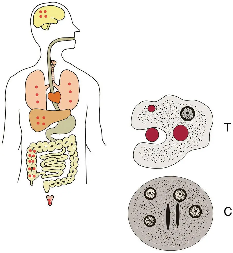 Figure 31 Life cycle of Entamoeba histolytica The trophozoite stage T has - фото 9