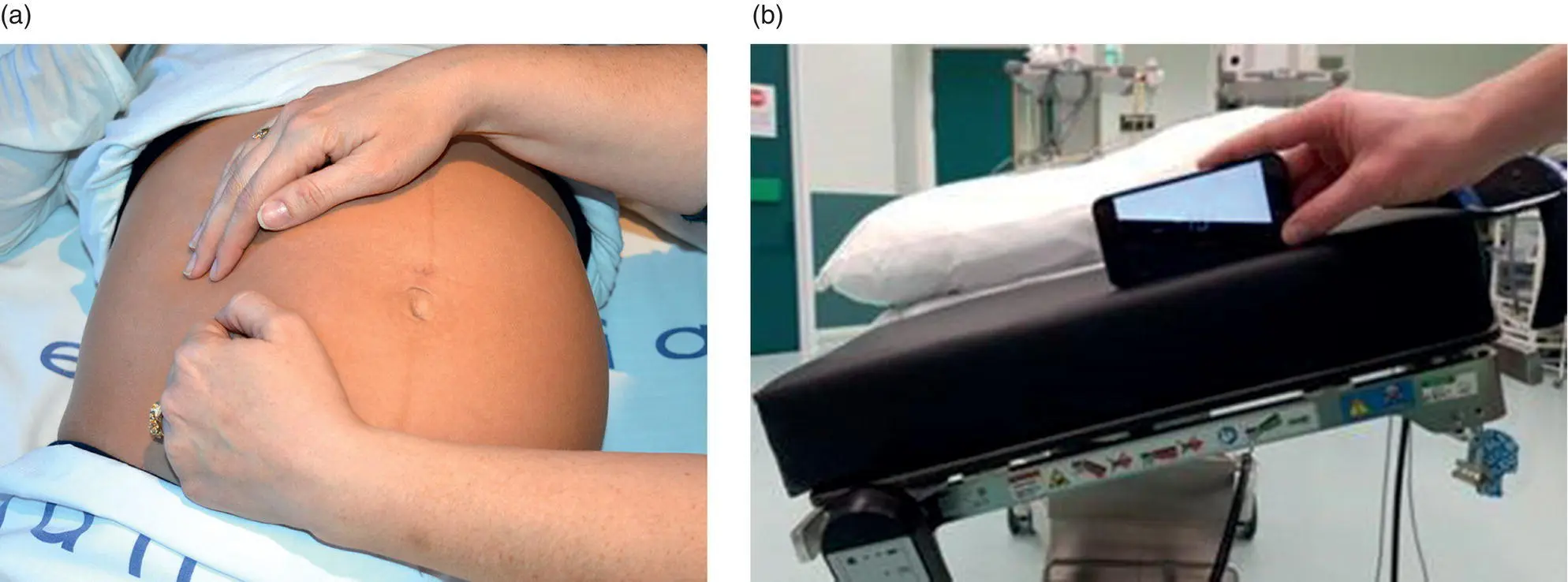 Figure 61 a Manual uterine displacement in the pregnant woman b Fifteen - фото 12