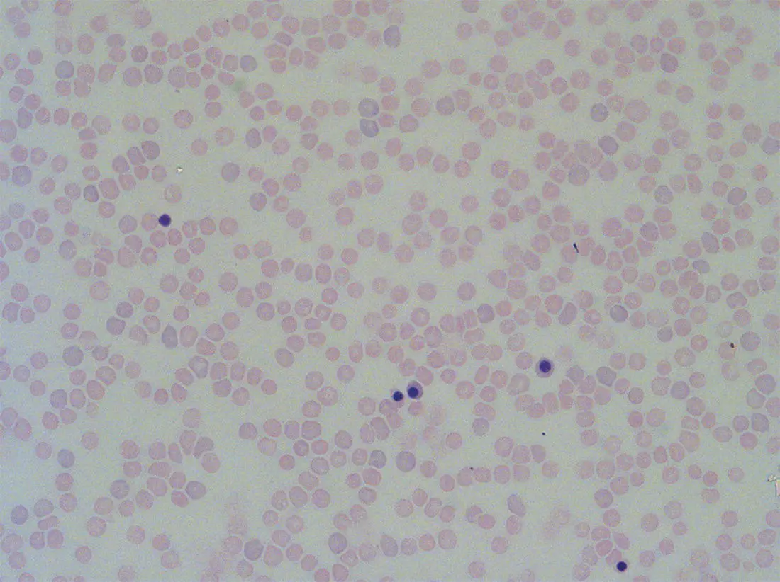 Fig 16 Second trimester 14 weeks fetal blood film showing typical - фото 7