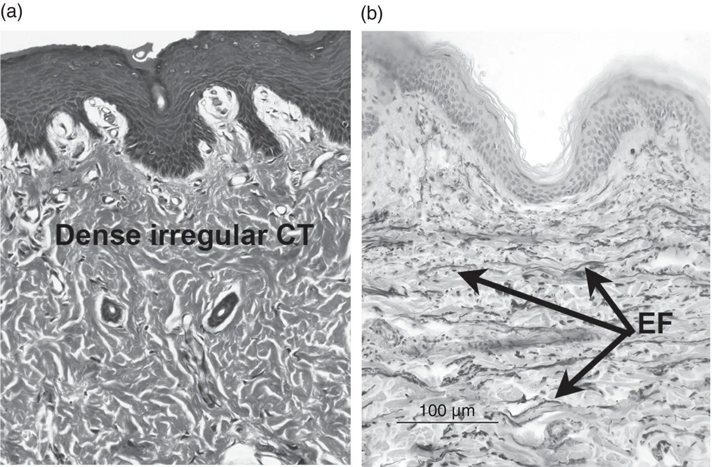 Figure 32 Dense irregular connective tissue in the dermis of the skin a - фото 11