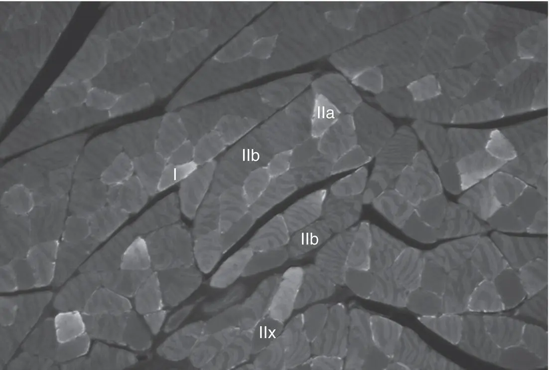 Figure 35 Distribution of different myosin heavy chains detected by - фото 14