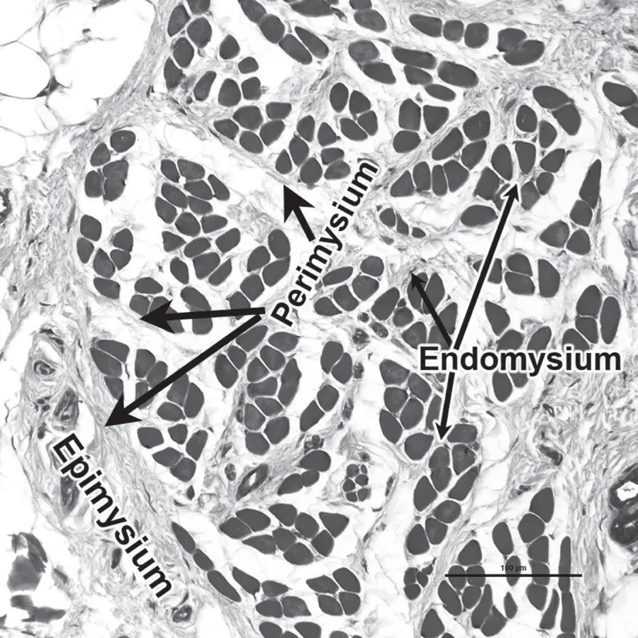 Figure 33 Extensions of deep fascia around and into individual muscle fibers - фото 12