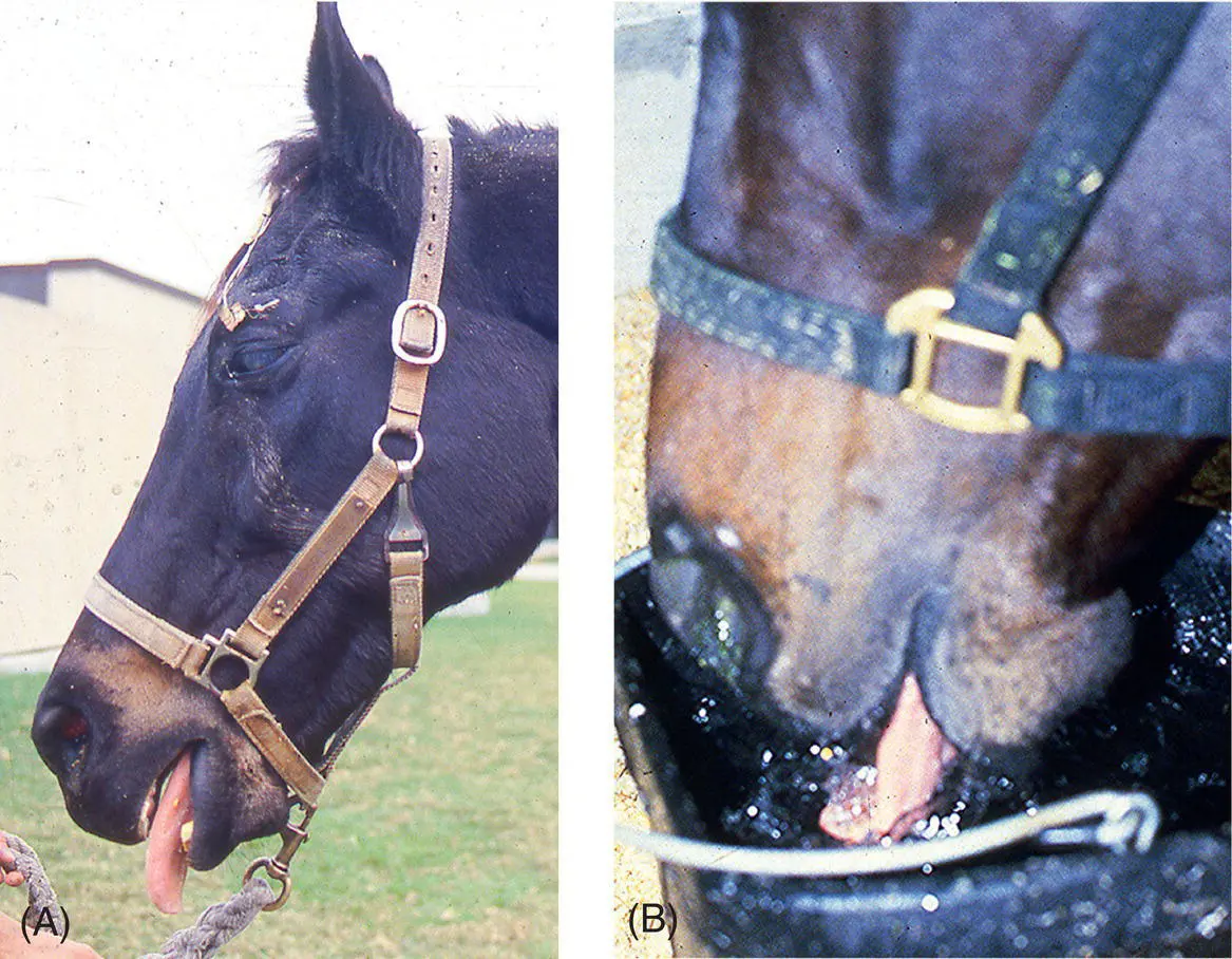 Figure 126 Asymmetric temporalis and masseter and pterygoid muscle atrophy - фото 109