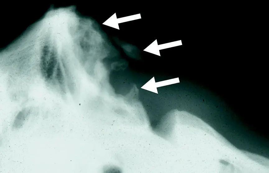 Figure 58 Radiographs of the atlantooccipital region of a horse demonstrating - фото 76