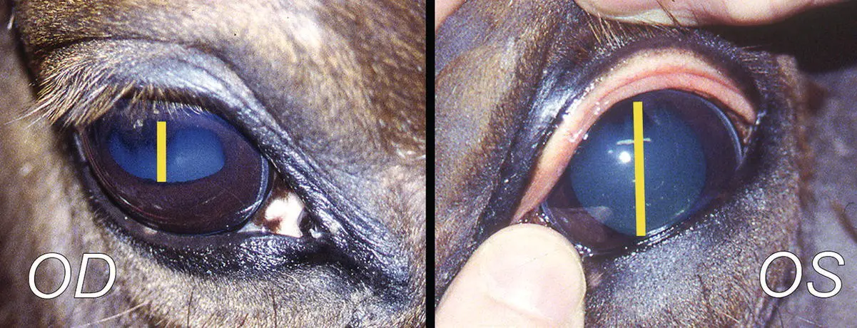 Figure 132 This case of polyneuritis involved the trigeminal nerves and quite - фото 112