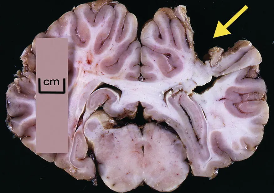 Figure 25 Large regions of the forebrain of large domestic animals can be - фото 18