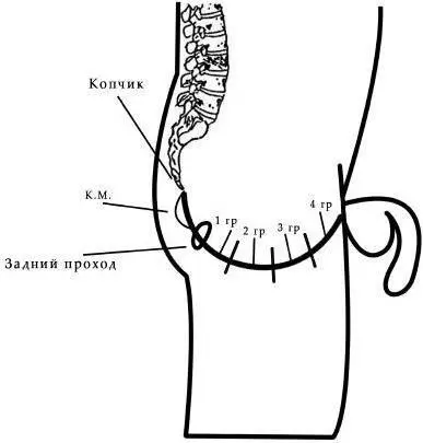 Рис 5 Начинаем с копчиковой мышцы КМ Напряглиотпустили Втянули задний - фото 5