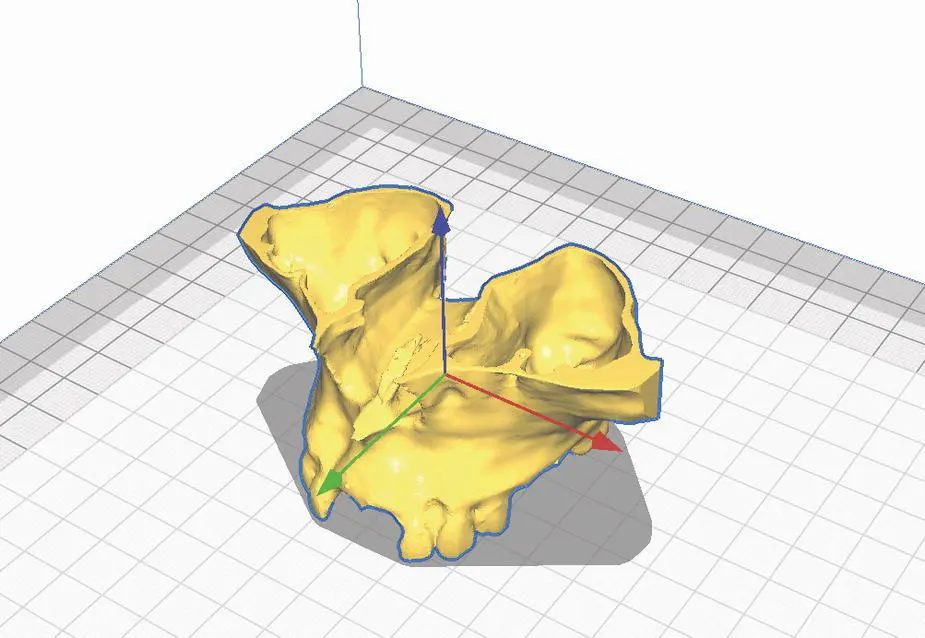 Figure 12 A 3D object reconstructed model of a maxillary CBCT scan is - фото 3