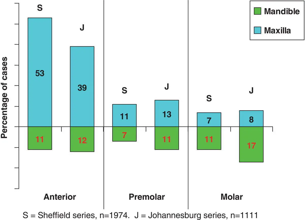 Figure 33 Site distribution of radicular cysts A comparison of 1111 cases - фото 8