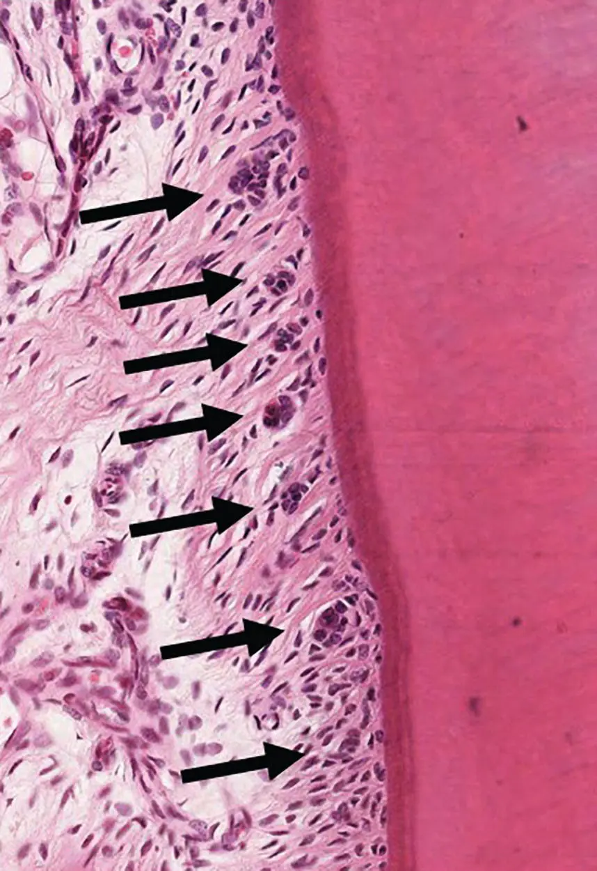 Figure 36 Rest cells of Malassez appear as multiple small islands of - фото 12