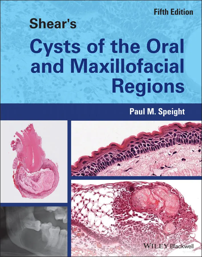 Table of Contents 1 Cover 2 Title Page Shears Cysts of the Oral and - фото 1