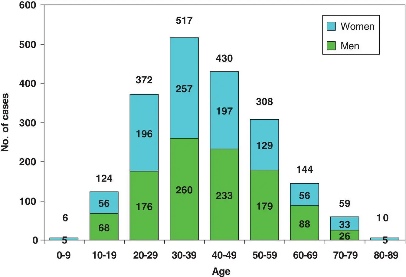 Figure 32 Age distribution of 1970 patients with radicular cysts from - фото 7