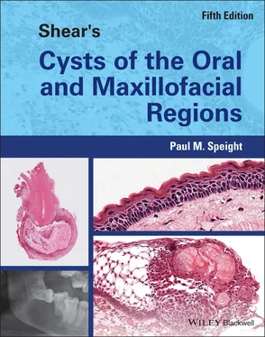 Paul M. Speight Shear's Cysts of the Oral and Maxillofacial Regions обложка книги