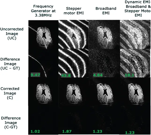 Figure 39 Retrospective EMI correction of a timevarying EMI using five - фото 67