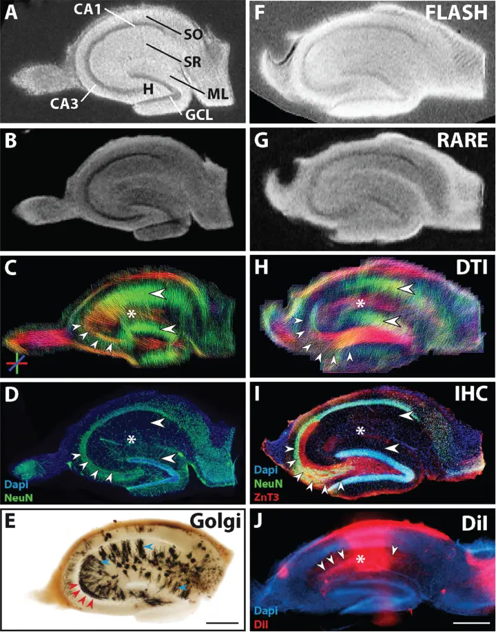 Figure 19 Magnetic resonance MR and histological images of fixed hippocampal - фото 12