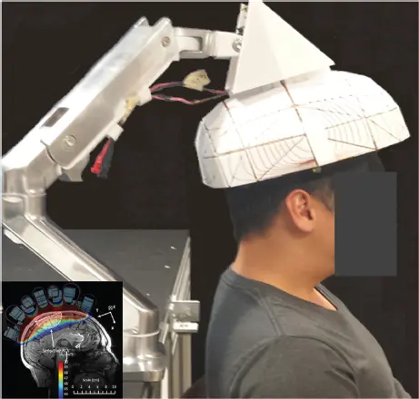 Figure 33 Singlesided brain magnetic resonance imaging under development for - фото 61