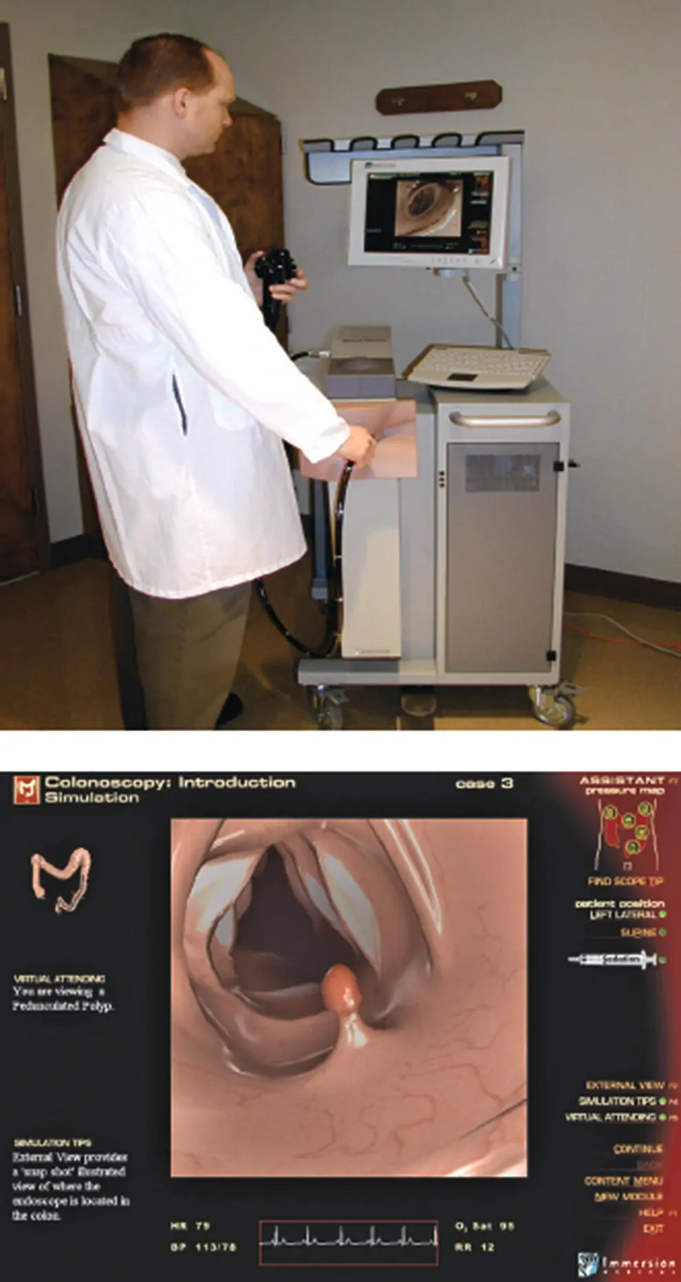 Figure 112 Immersion AccuTouch colonoscopy simulator Figure 113 GI Mentor - фото 19