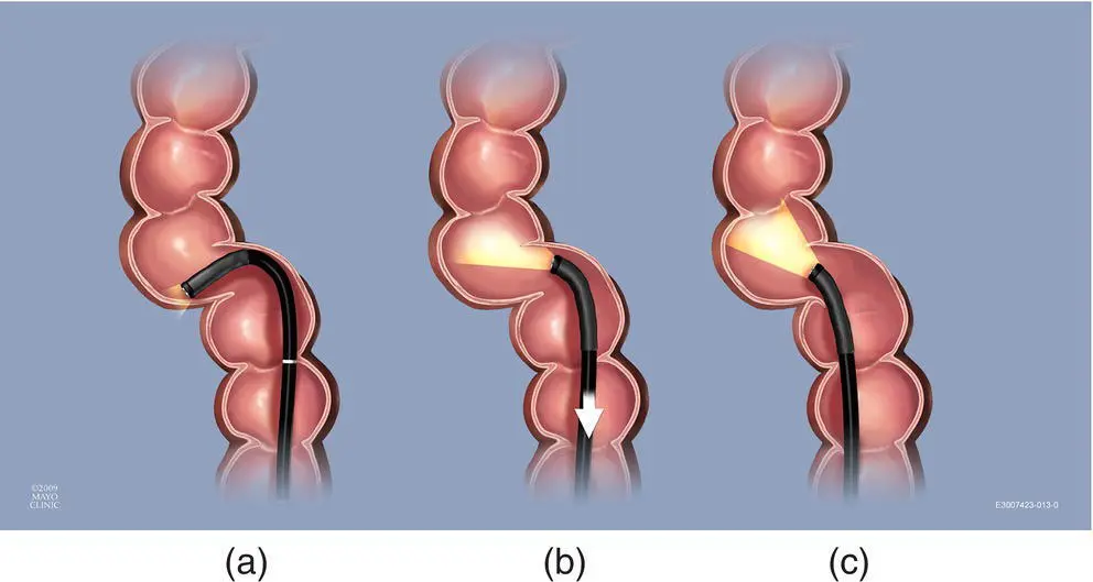 Figure 627 Acute turn When attempting to navigate an acute turn novices will - фото 84