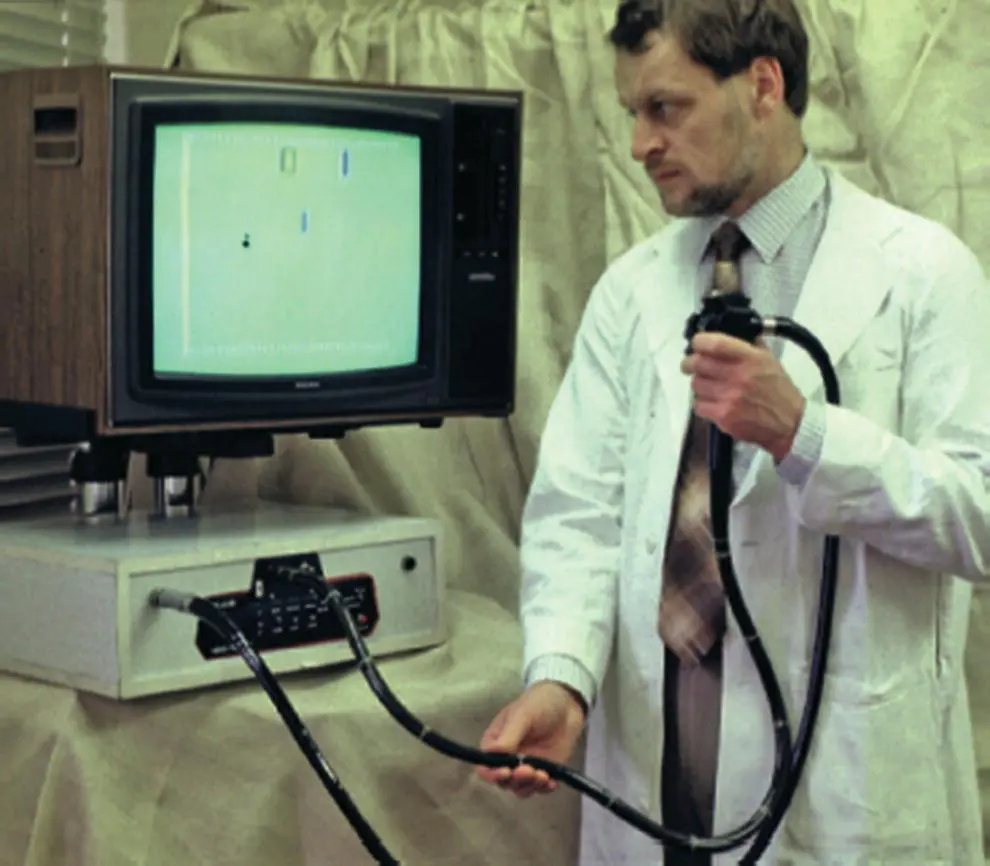 Figure 16 Endoscopic Pong Game 1977 Tested handeye coordination - фото 9