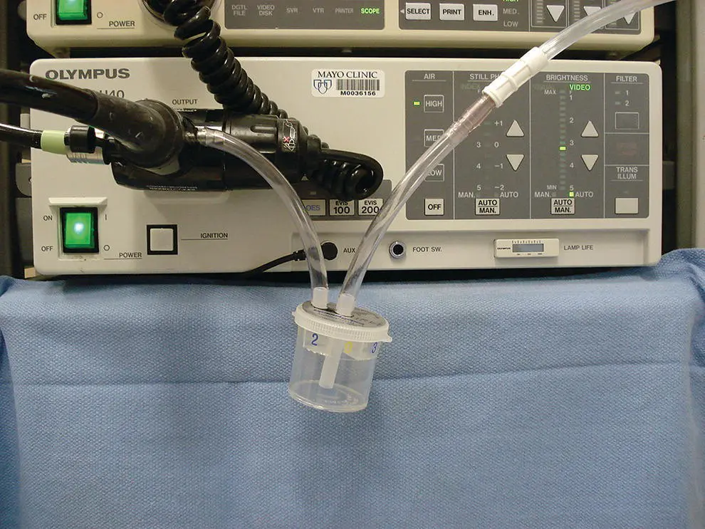 Figure 611 Trap in suction circuit When a polyp is removed with a snare a - фото 61