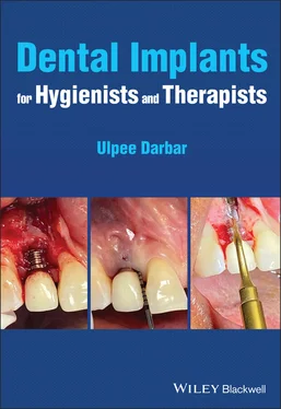 Ulpee R. Darbar Dental Implants for Hygienists and Therapists обложка книги