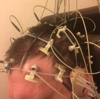 Die Nervenzellen funktionieren mit elektrischem Strom Allerdings viel - фото 3