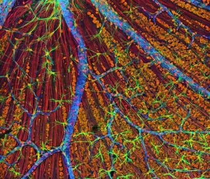 Das Fachgebiet der Neurologie beschäftigt sich mit den Nerven Neuron Nerv - фото 1