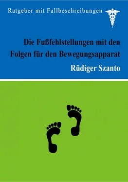 Rüdiger Szanto Die Fußfehlstellungen mit den Folgen für den Bewegungsapparat обложка книги