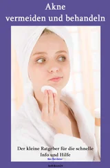 Max Rat-Geber - Akne