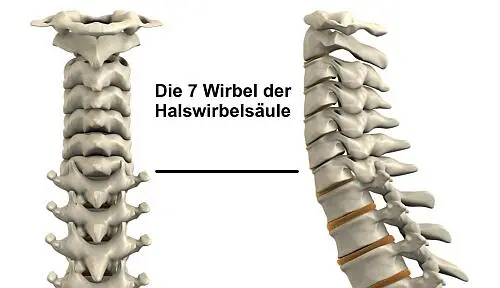 Das HalswirbelsäulensyndromMancher kennt es vom morgendlichen aufwachen der - фото 12
