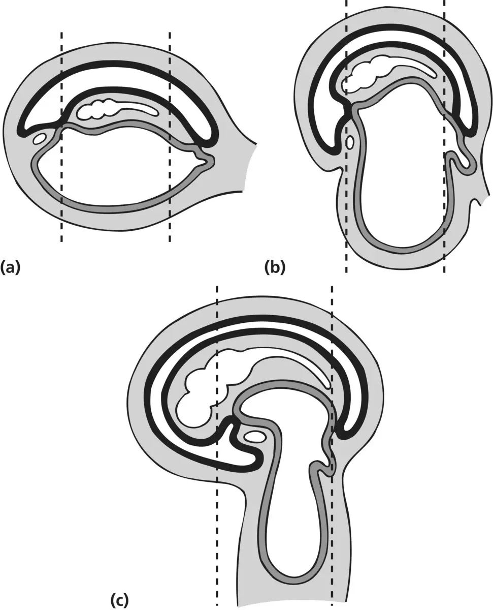 Figure 15 a As the neural tube is enclosed within the intraembryonic - фото 6