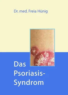 Dr. Freia Hünig Das Psoriasis-Syndrom обложка книги