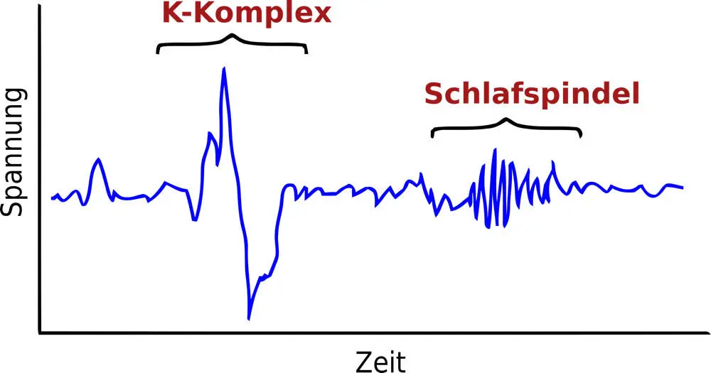 Bereits in dieser Phase können Träume auftreten die oft sehr realitätsbezogen - фото 3
