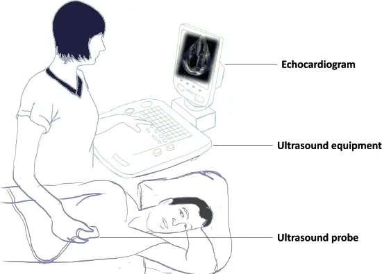 Figure 27 The echocardiography method The patient lies in the left lateral - фото 10