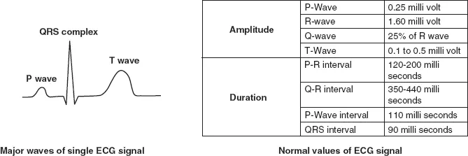 Figure 23 Major waves of a single ECG signal and the normal values of ECG - фото 6