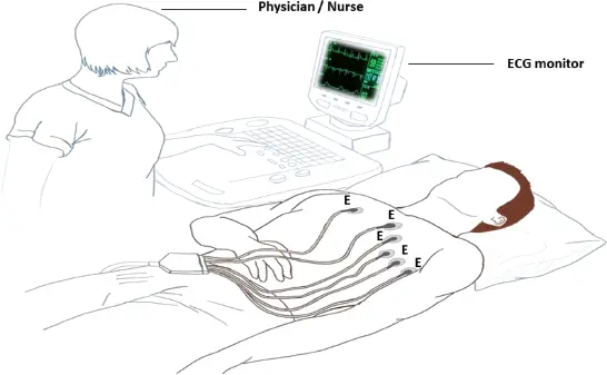 Figure 22 ECG E denotes electrodes placed for detecting the small electrical - фото 5