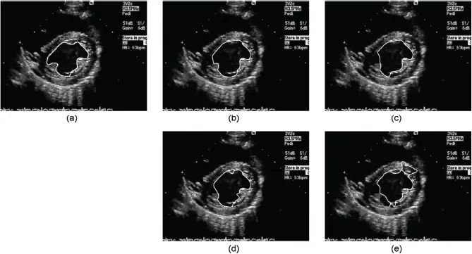 Figure 11 Images for boundary detection in different views of heart with - фото 2