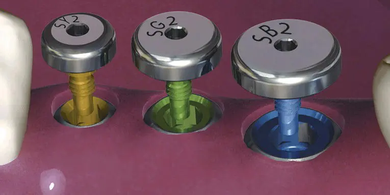Figure 118 Examples of cover screws Courtesy of BioHorizons Figure 119 - фото 21