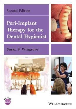 Susan S. Wingrove Peri-Implant Therapy for the Dental Hygienist обложка книги