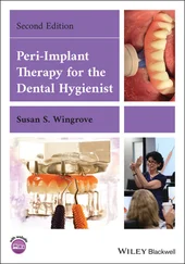 Susan S. Wingrove - Peri-Implant Therapy for the Dental Hygienist