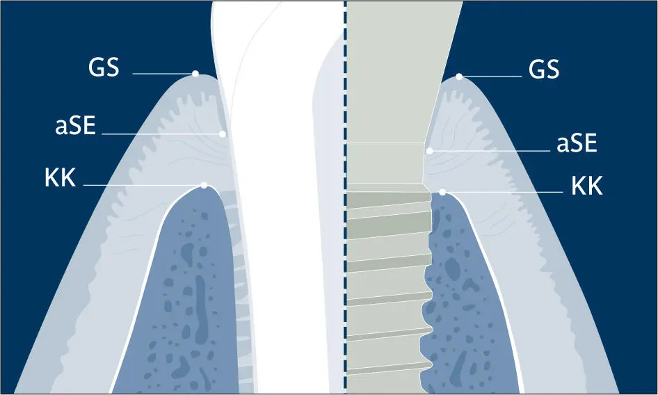 Abb 11 Illustration der Struktur von klinisch gesundem supraalveolärem - фото 15