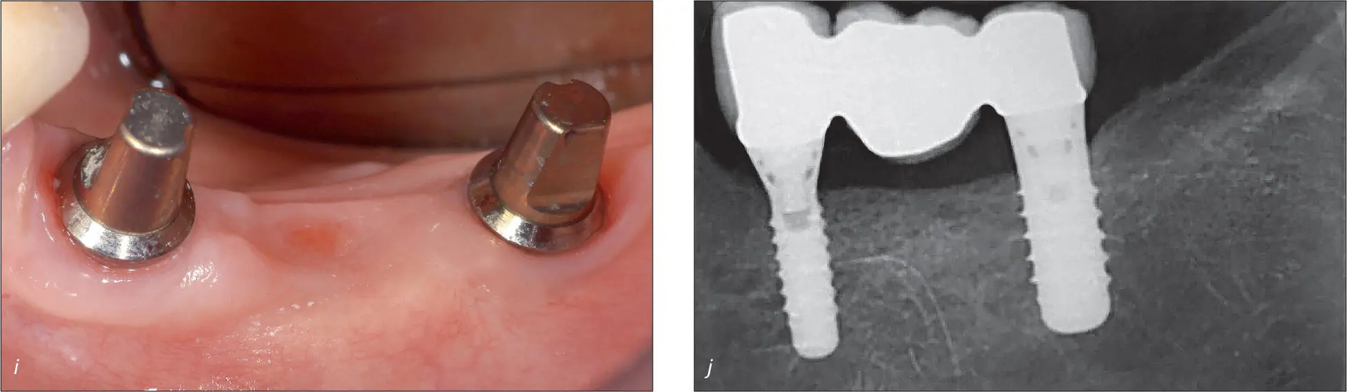 Abb 8 i und j Klinische und radiologische Kontrolluntersuchung nach 1 Jahr - фото 78