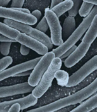 Escherichia E coli sind Bakterien die Krankheiten wie Darminfektionen - фото 35